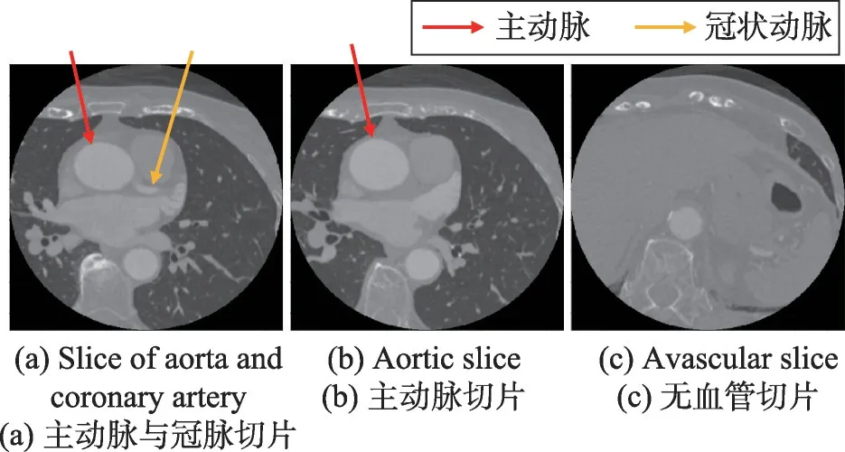 图片[11]-嵌入注意力机制的多模型融合冠脉CTA分割算法-游戏花园